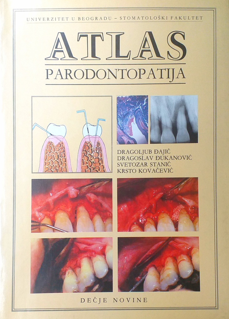 ATLAS PARODONTOPATIJA