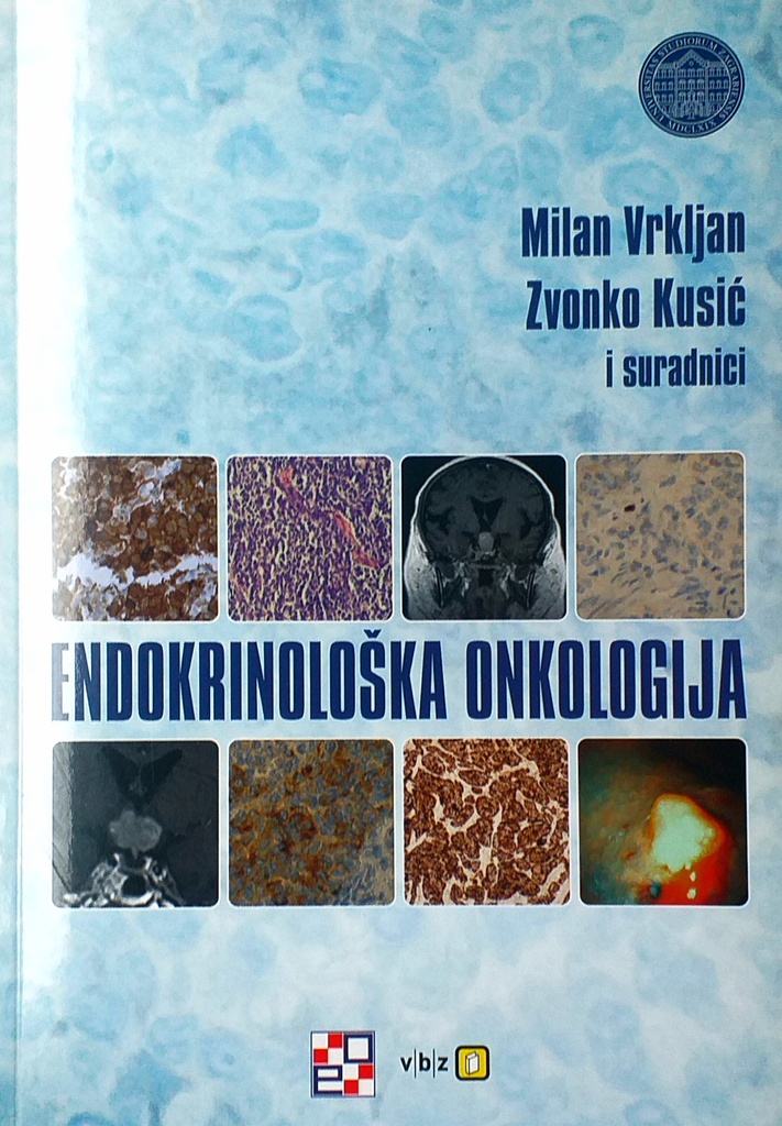 ENDOKRINOLOŠKA ONKOLOGIJA