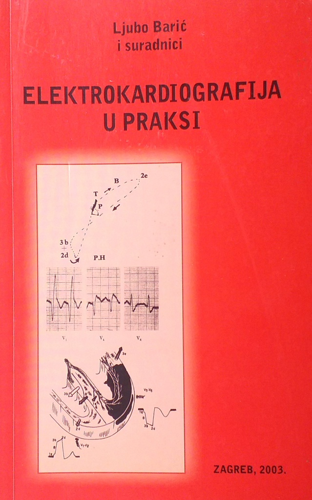 ELEKTROKARDIOGRAFIJA U PRAKSI