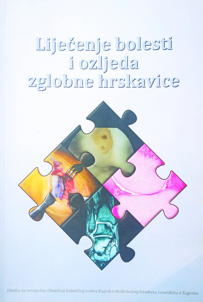 LIJEČENJE BOLESTI I OZLJEDA ZGLOBNE HRSKAVICE