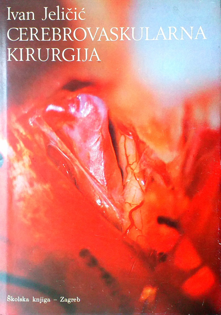 CEREBROVASKULARNA KIRURGIJA