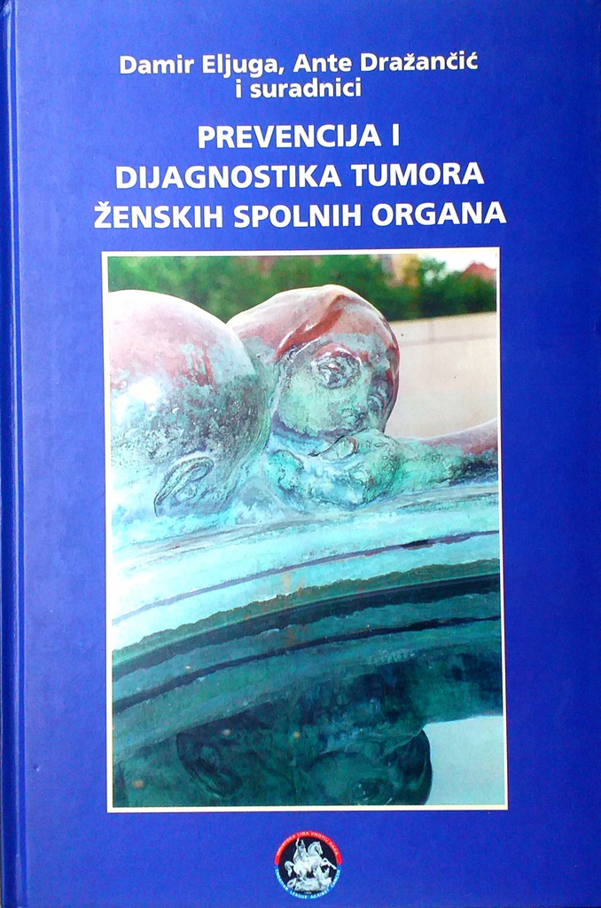 PREVENCIJA I DIJAGNOSTIKA TUMORA ŽENSKIH SPOLNIH ORGANA