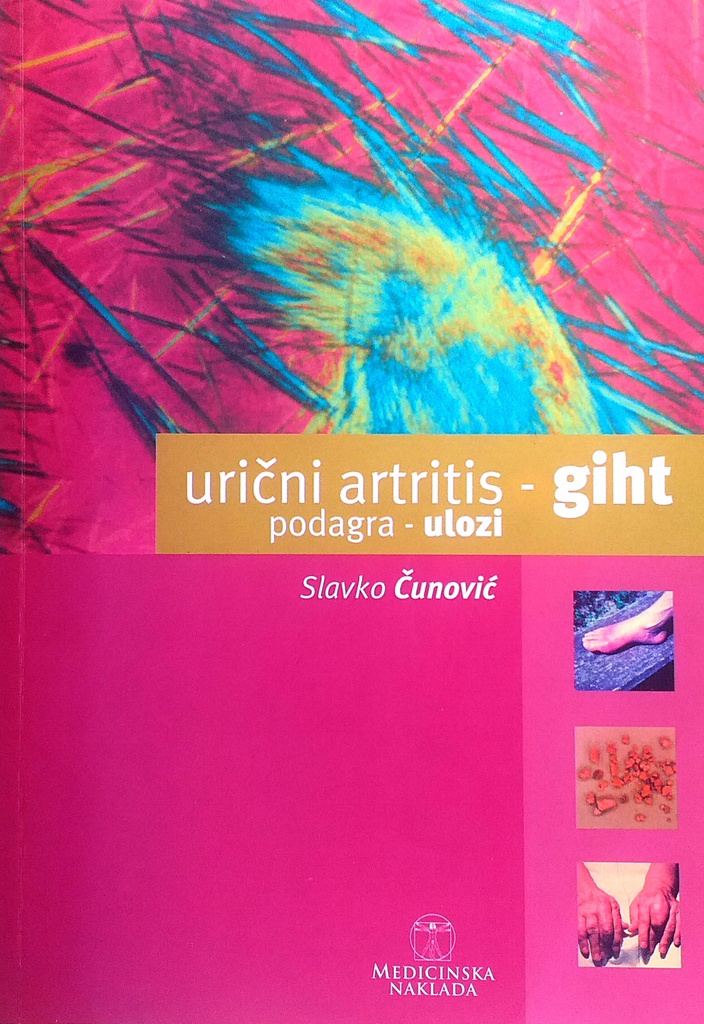 URIČNI ARTRITIS - GIHT