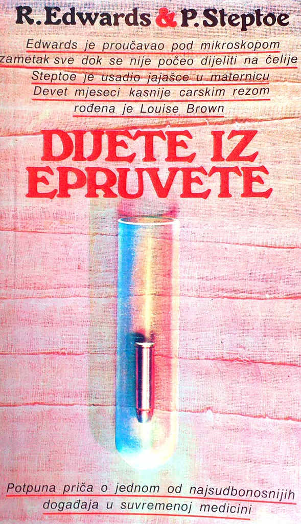 DIJETE IZ EPRUVETE