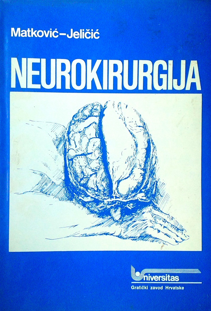 NEUROKIRURGIJA