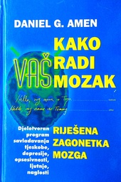 [C-11-3B] KAKO RADI VAŠ MOZAK