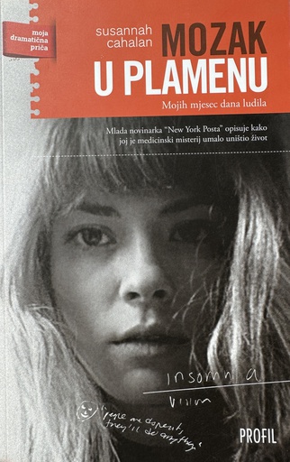 [E-01-5B] MOZAK U PLAMENU