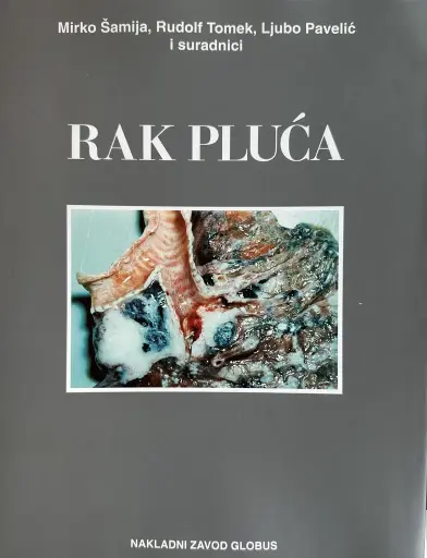 [E-02-1A] RAK PLUĆA